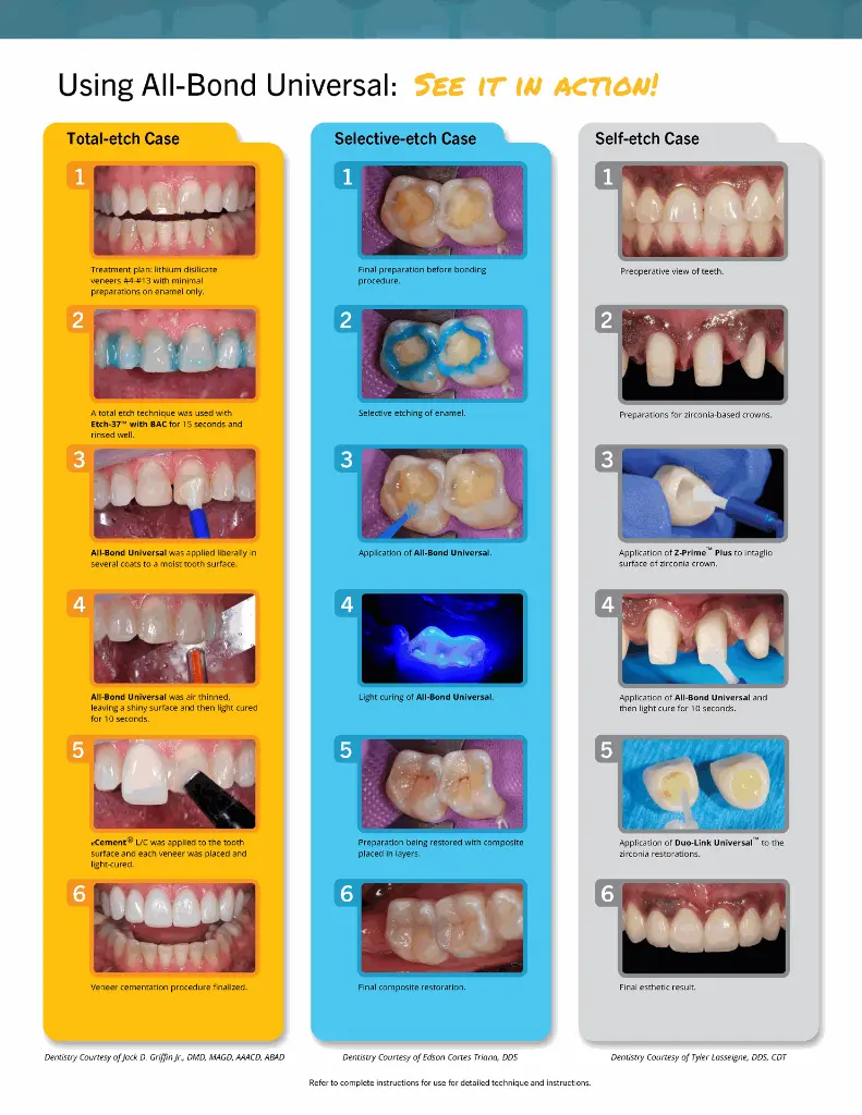 Pages de AllBondUniversalBrochure_Web-3_Page_4.webp